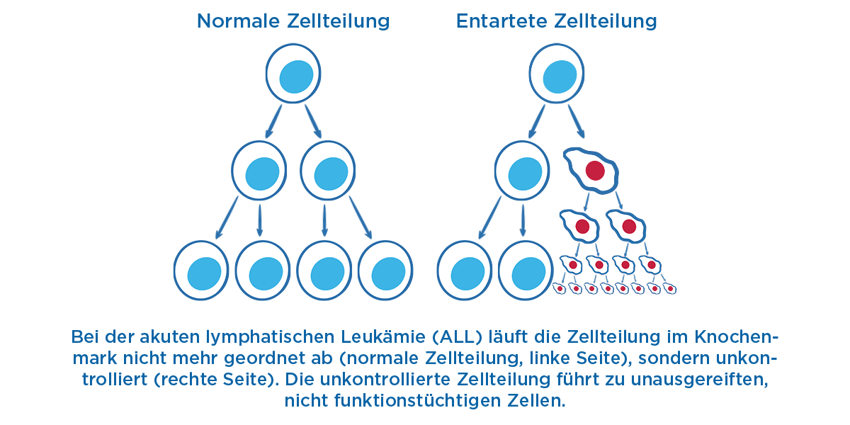 Normale Zellteilung: Bei einer funktionierenden Zellteilung gehen aus der Ursprungszelle (hier dargestellt als blauer Kreis mit blauem Zellkern) bei jeder Zellteilung identische Tochterzellen hervor. Entartete Zellteilung: Aus einer gesunden Zelle gehen aus gesunden Ursprungszellen entartete Tochterzellen hervor (hier dargestellt als unregelmäßig und längliche Kreise mit rotem Zellkern).