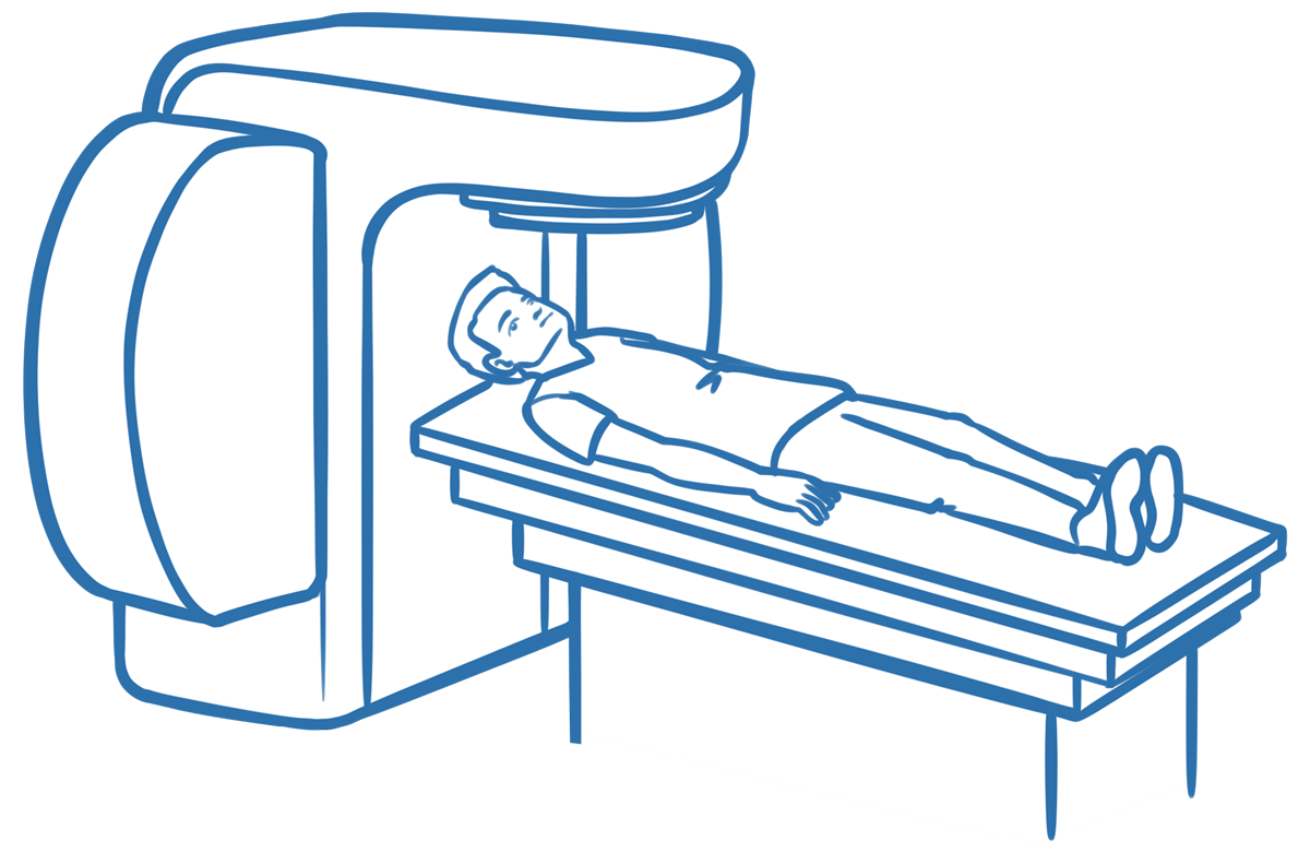 Illustration eines Patienten rücklings auf einer Liege und einem Bestrahlungsgerät über Kopf und Brust