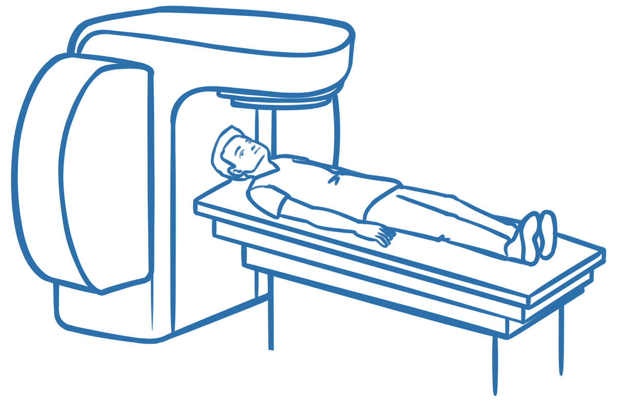 Illustration eines Patienten rücklings auf einer Liege und einem Bestrahlungsgerät über Kopf und Brust