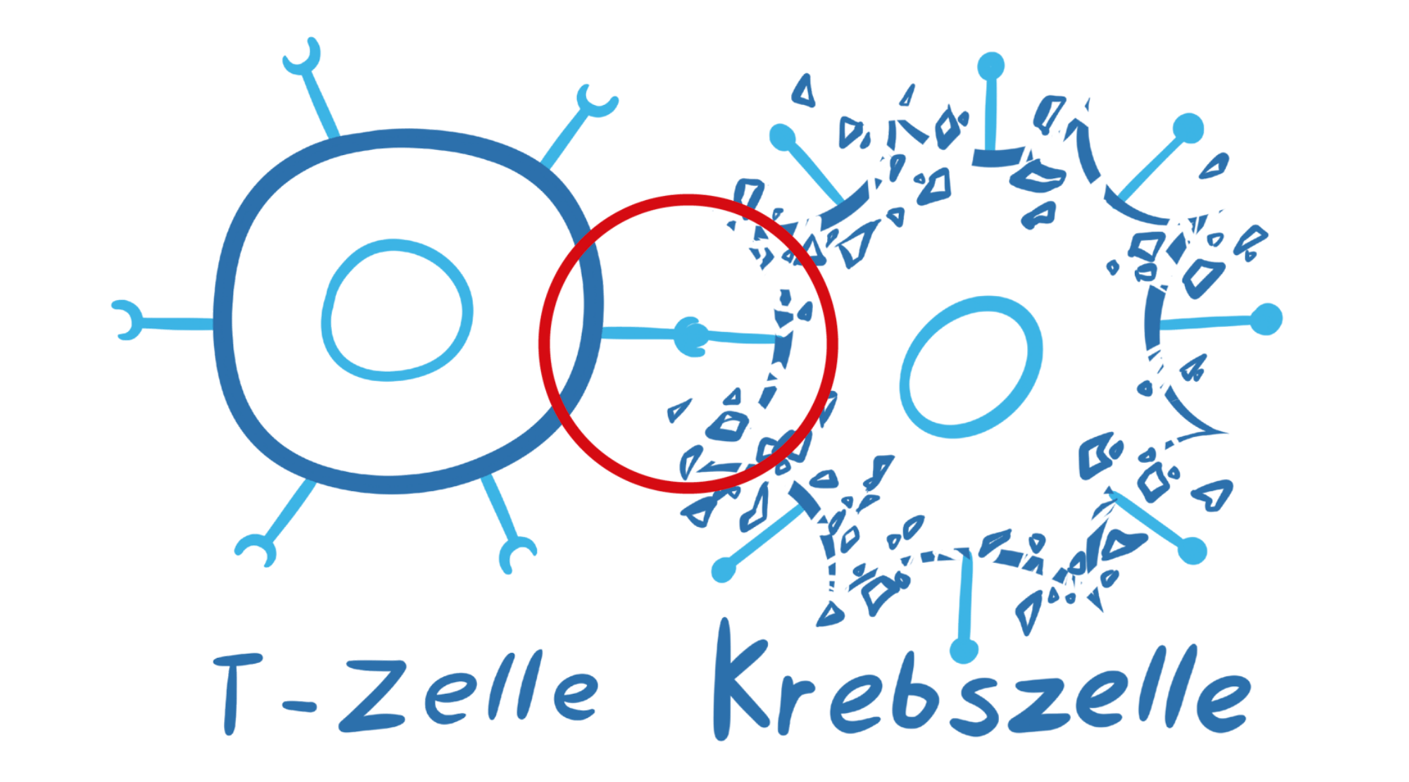 Illustration einer CAR-T-Zelle, die eine Krebszelle zerstört, indem sie mit dem chimären Antigenrezeptor die Krebszelle erkennt, hervorgehoben mit einem roten Kreis