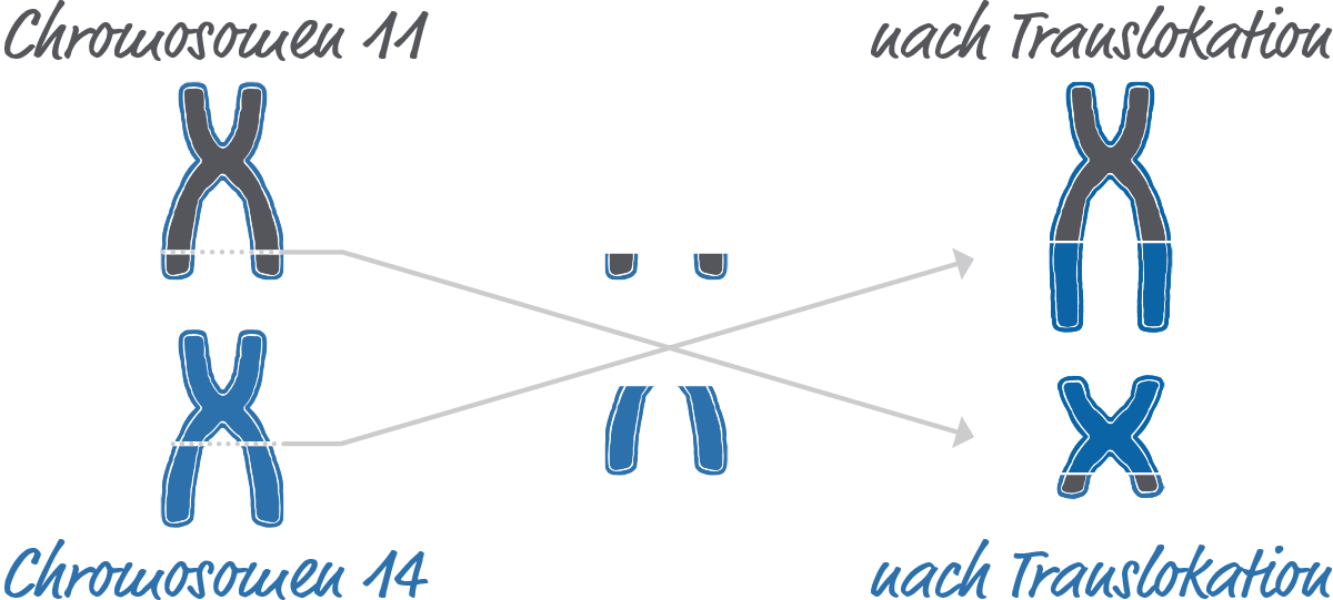 Illustration von Chromosom 11 in grau und Chromosom 14 in blau, welche jeweils einen Teil verlieren. Nach falscher Zusammensetzung, als Translokation beschriftet, tragen beide Chromosomen jeweils ein Stück des anderen Chromosoms