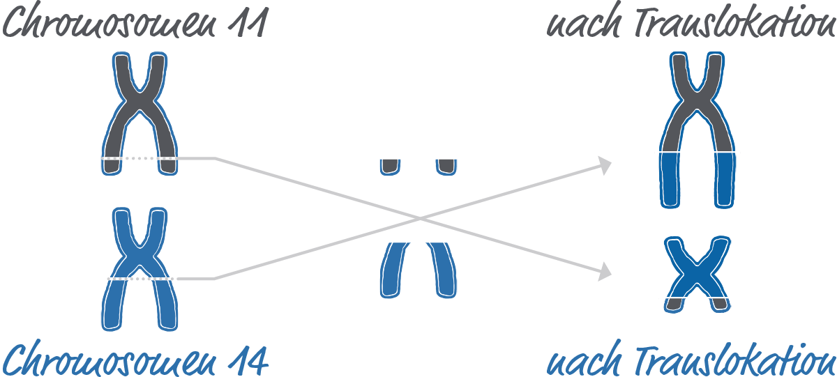 Illustration von Chromosom 11 in grau und Chromosom 14 in blau, welche jeweils einen Teil verlieren. Nach falscher Zusammensetzung, als Translokation beschriftet, tragen beide Chromosomen jeweils ein Stück des anderen Chromosoms